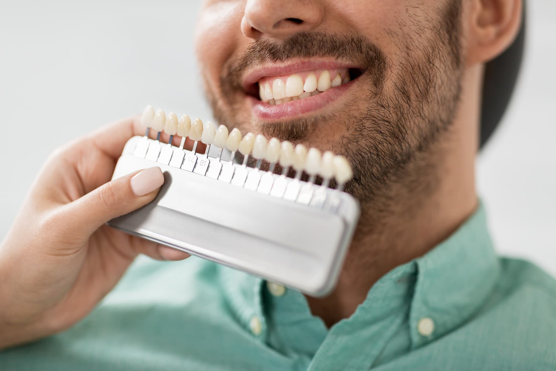 Guide de couleur des dents